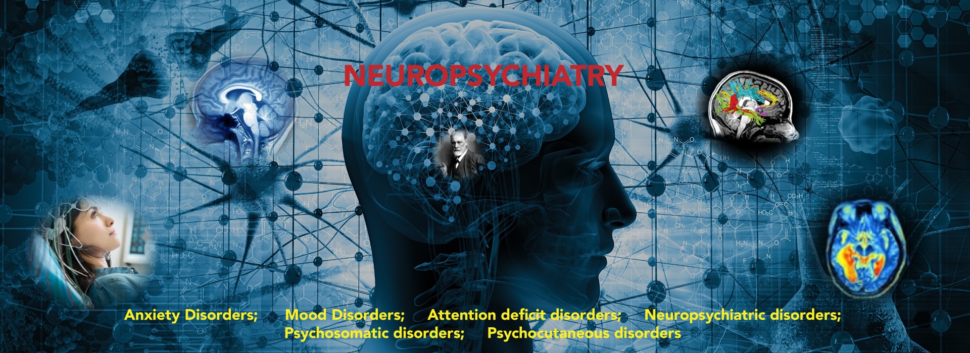 neuropsychiatry, FDA Approved TMS helps Mood, Anxiety, Attention Deficit disorders